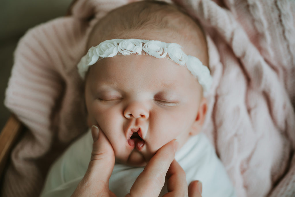 newborn girl squished cheeks